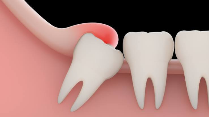 teeth