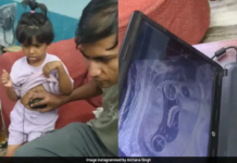 सोशल मीडिया पर इन दिनों पिता-पुत्री का एक वीडियो वायरल हो रहा है। इसमें पिता बेटी के जंक फूड खाने का सबसे बड़ा नुकसान दिखा रहे